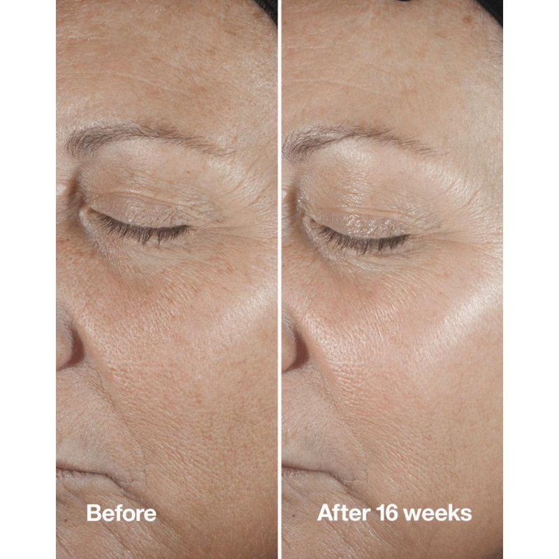 Clinique Smart Clinical Repair Wrinkle Correcting Serum 50ml