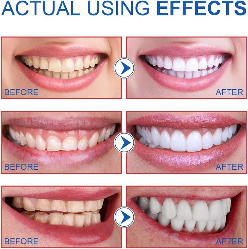 2PCS-SP-6 Whitening Toothpaste – Enamel-Safe, Fluoride-Free, Fresh Mint