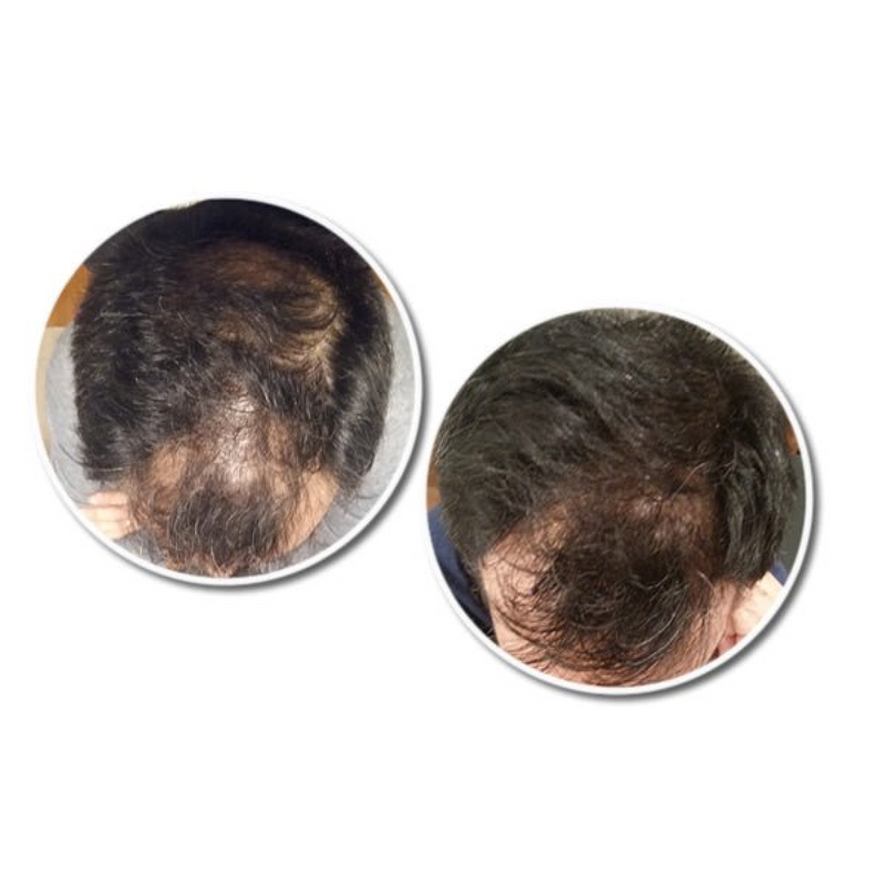 R12 Tri Peptide Active Hair Serum for Men 30 ml