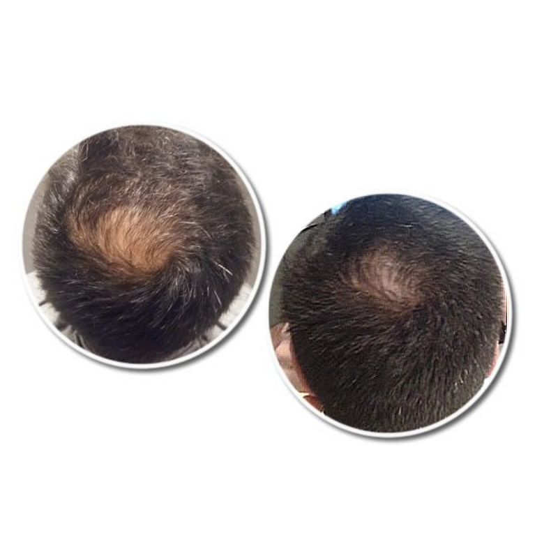 R12 Tri Peptide Active Hair Serum for Men 30 ml