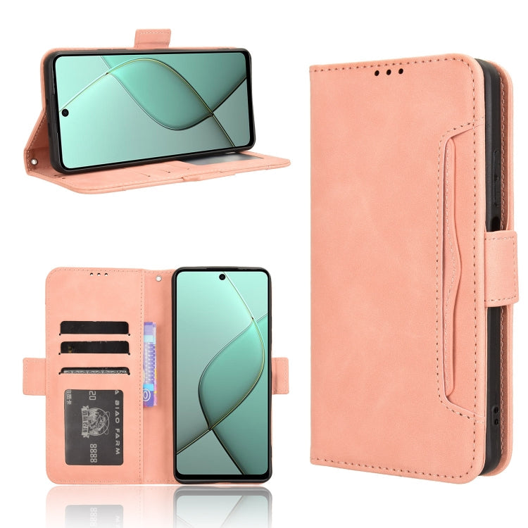 Skin Feel Calf Texture Card Slots Leather Phone Case, For Tecno Pova 6 4G, For Tecno Camon 30 Pro 5G, For Tecno Camon 30 5G / 4G, For Tecno Pova 6 Pro 5G