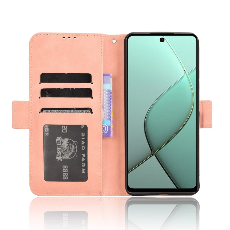 Skin Feel Calf Texture Card Slots Leather Phone Case, For Tecno Pova 6 4G, For Tecno Camon 30 Pro 5G, For Tecno Camon 30 5G / 4G, For Tecno Pova 6 Pro 5G