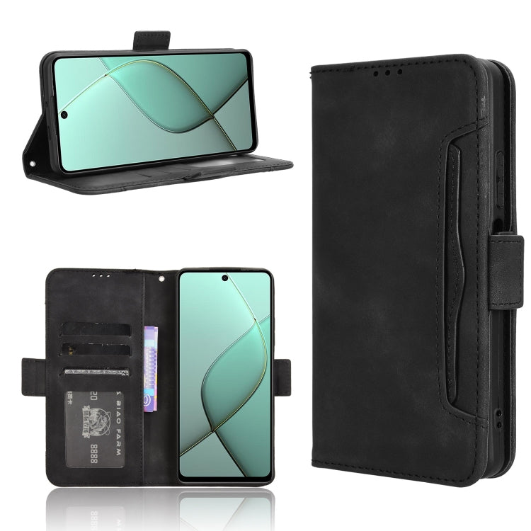 Skin Feel Calf Texture Card Slots Leather Phone Case, For Tecno Pova 6 4G, For Tecno Camon 30 Pro 5G, For Tecno Camon 30 5G / 4G, For Tecno Pova 6 Pro 5G