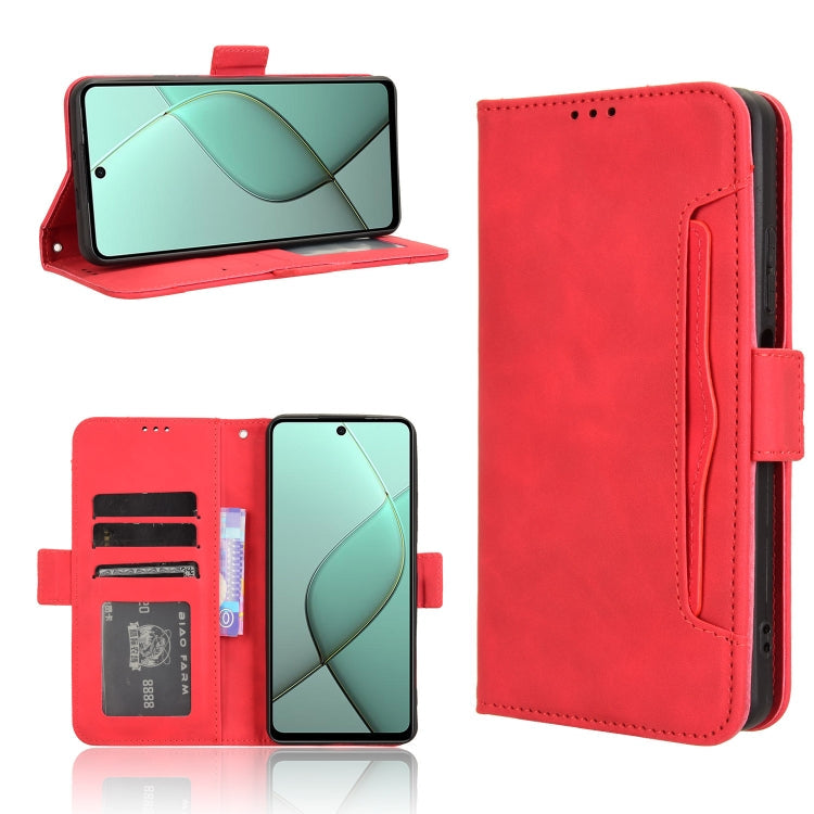 Skin Feel Calf Texture Card Slots Leather Phone Case, For Tecno Pova 6 4G, For Tecno Camon 30 Pro 5G, For Tecno Camon 30 5G / 4G, For Tecno Pova 6 Pro 5G