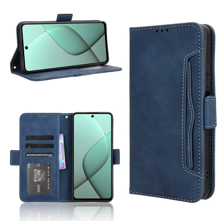 Skin Feel Calf Texture Card Slots Leather Phone Case, For Tecno Pova 6 4G, For Tecno Camon 30 Pro 5G, For Tecno Camon 30 5G / 4G, For Tecno Pova 6 Pro 5G
