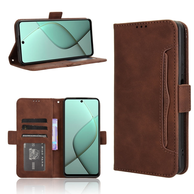 Skin Feel Calf Texture Card Slots Leather Phone Case, For Tecno Pova 6 4G, For Tecno Camon 30 Pro 5G, For Tecno Camon 30 5G / 4G, For Tecno Pova 6 Pro 5G