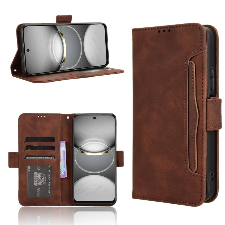 Skin Feel Calf Texture Card Slots Leather Phone Case, For Tecno Pova 6 4G, For Tecno Camon 30 Pro 5G, For Tecno Camon 30 5G / 4G, For Tecno Pova 6 Pro 5G