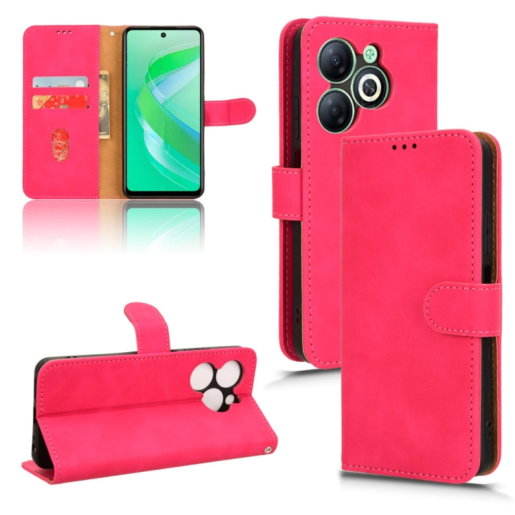 Skin Feel Magnetic Flip Leather Phone Case, For Infinix GT 10 Pro, For Infinix Hot 30 5G, For Infinix Note 30 5G, For Infinix Note 30i