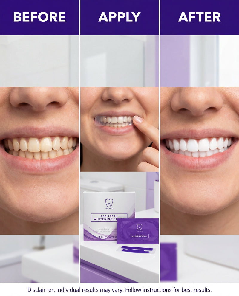 p80™ Teeth Whitening Strips