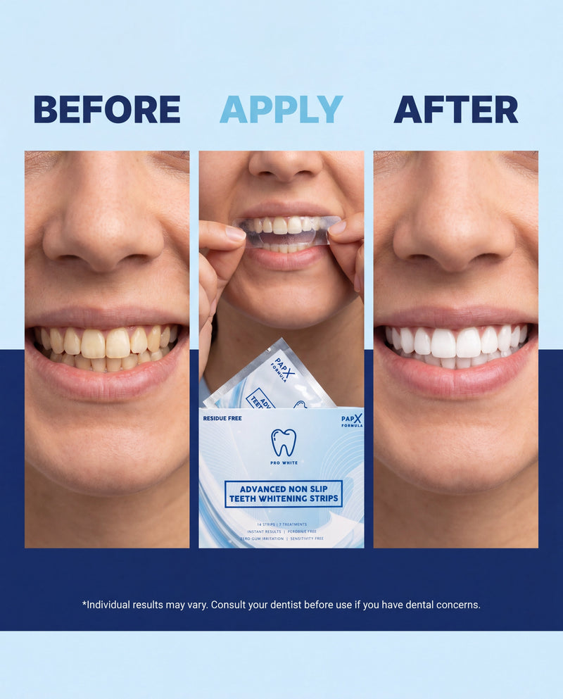 PAP-X™ Advanced Non-Slip Teeth Whitening Strips