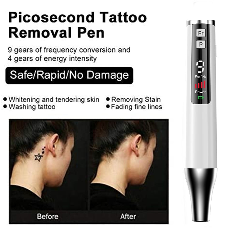 AA-A401 Small Freckle and Mole Removal Pen Tattoo and Eyebrow Removal Beauty Instrument, Red Light Plug-in, Blu-ray Plug-in, Red Light Battery, Blu-ray Battery