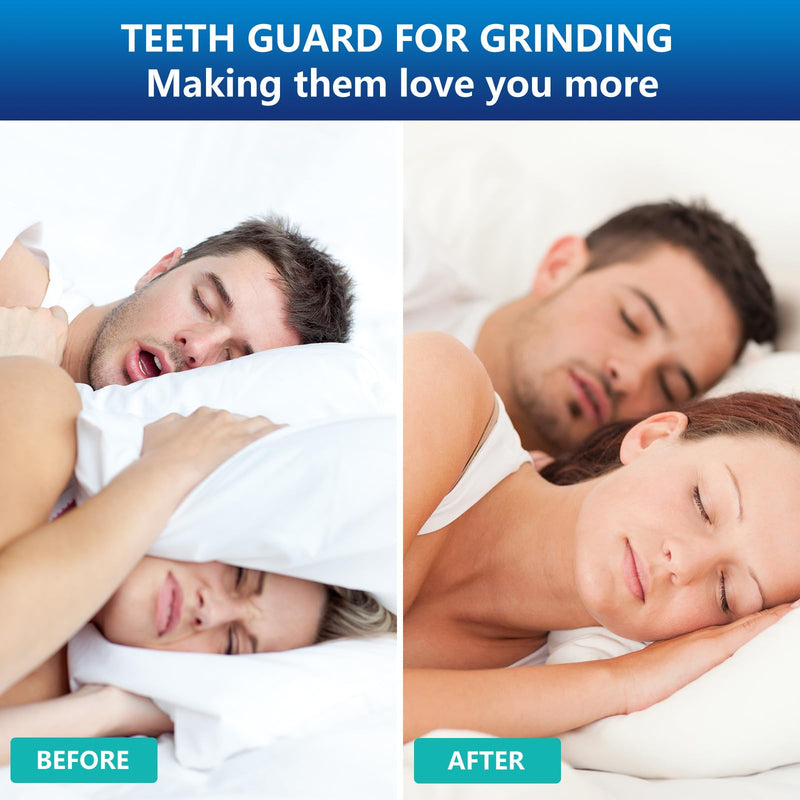 Mouth Guard for Grinding Teeth at Night | Night Guards