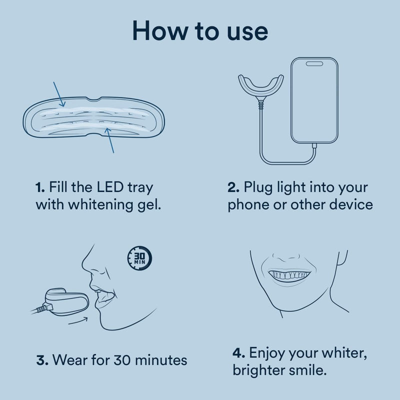 Auraglow Teeth Whitening Kit – Wired LED Accelerator Light, 35% Carbamide Peroxide, 12 Treatments, Whitens Up to 10 Shades in 7 Days