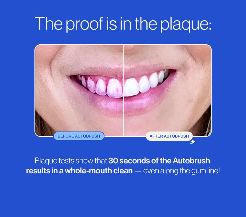 autobrush Kids Electric Toothbrush – ADA Accepted U-Shaped Toothbrush for Ages 6-8 | Clinically Proven Up to 5.1x Cleaner | Unicorn