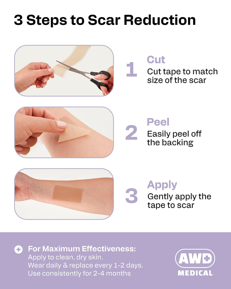 AWD Silicone Scar Tape Roll 60in – Medical-Grade Scar Tape for Surgical Scars, C-Section, Tummy Tuck, Reusable Scar Sheets