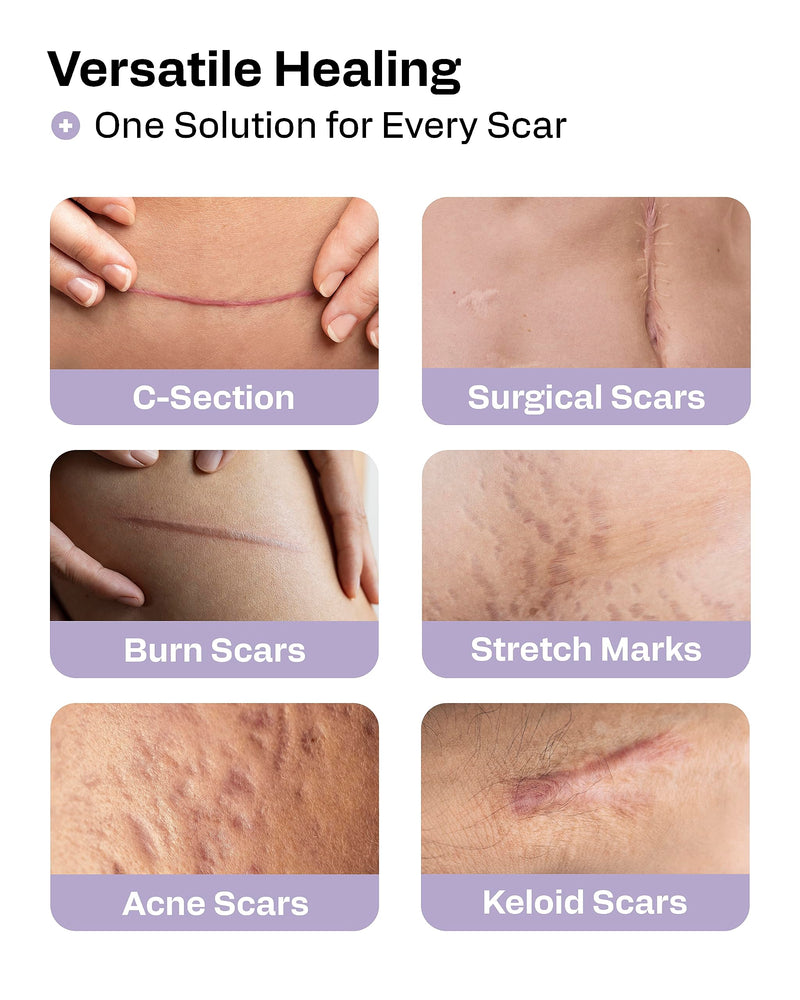AWD Silicone Scar Tape Roll 60in – Medical-Grade Scar Tape for Surgical Scars, C-Section, Tummy Tuck, Reusable Scar Sheets