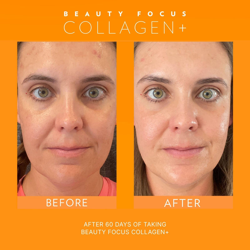 Beauty Focus Collagen Plus – Peach Flavor | 1.0 oz, 30 Packets | Skin Hydration & Hair Support