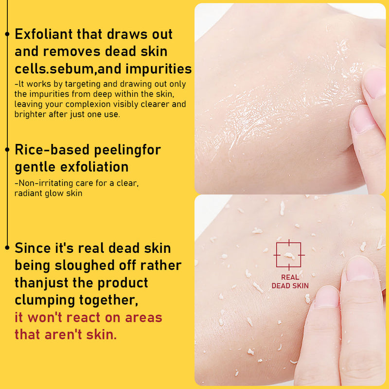 Phofay Exfoliating Set