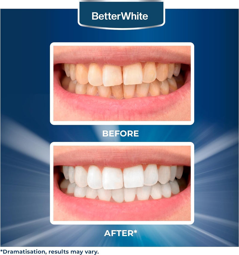 BetterWhite Teeth Whitening Strips – 28 Strips (14 Treatments) – Enamel Safe