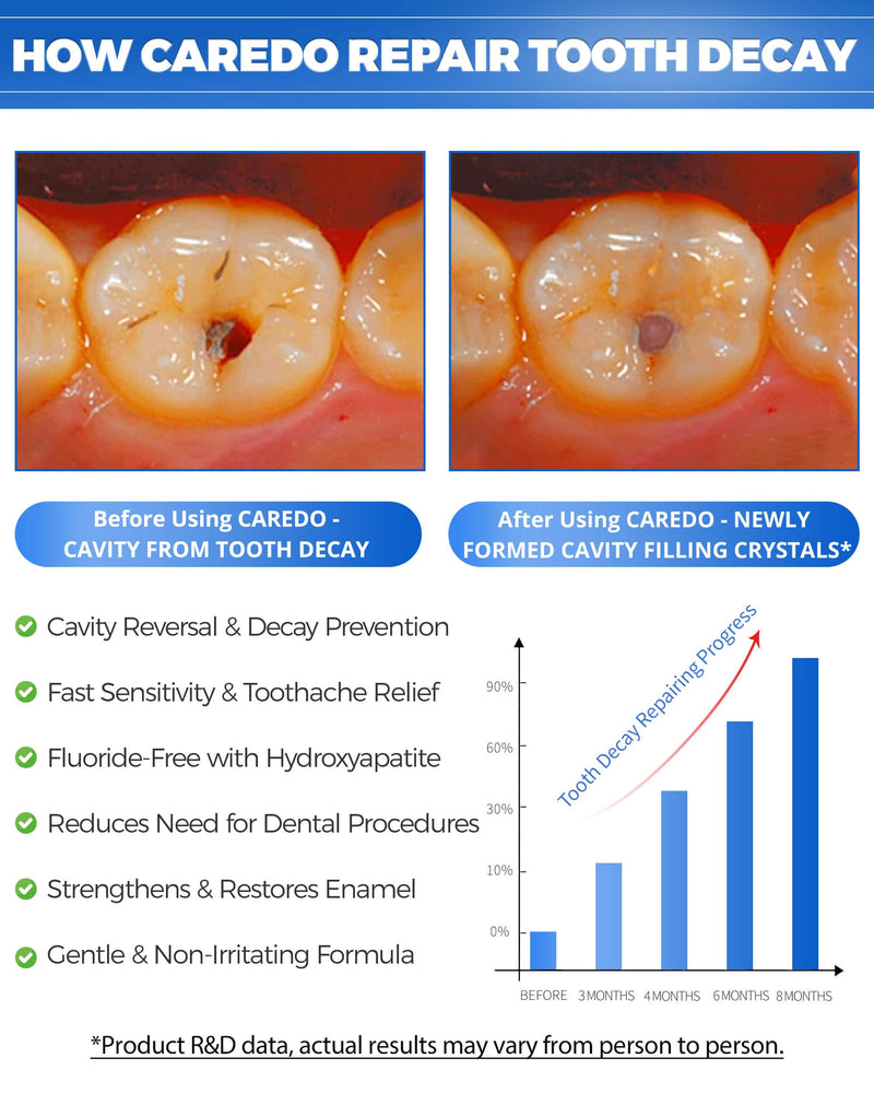 CAREDO Fluoride-Free Hydroxyapatite Toothpaste – Cavity Reversal (2-Pack)