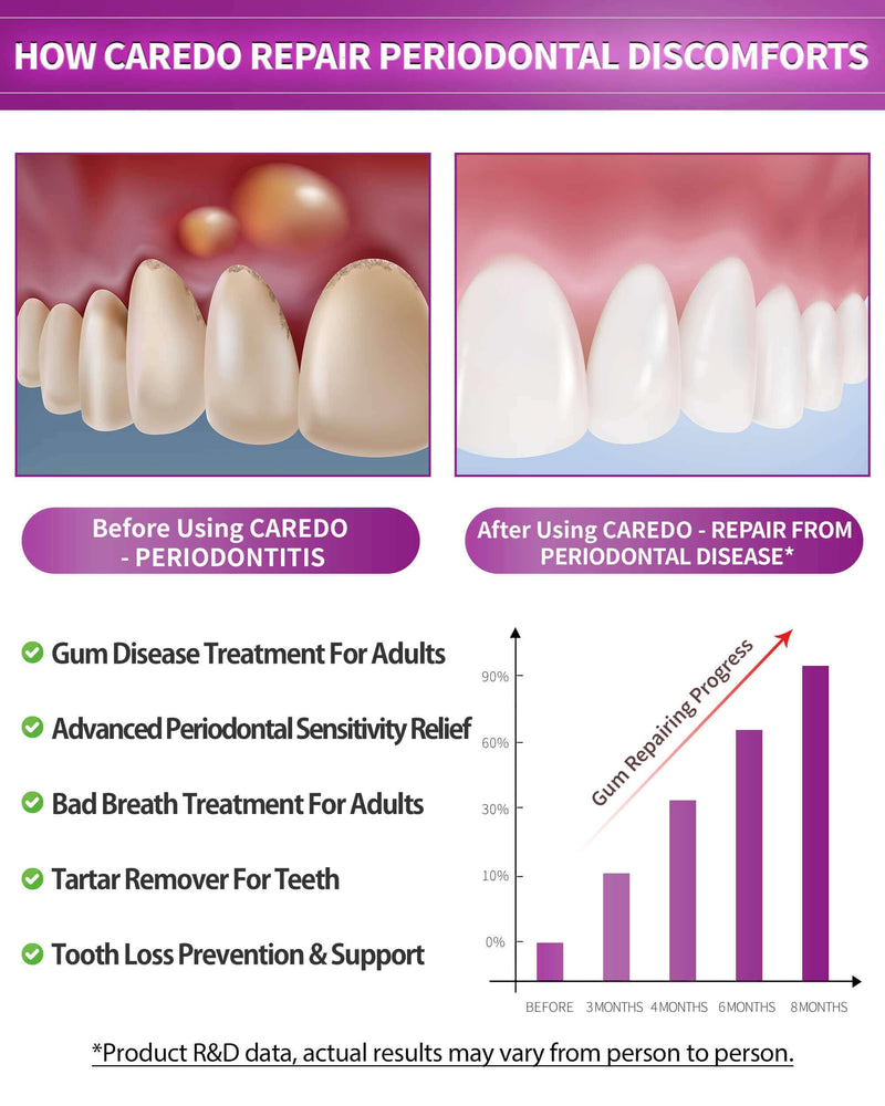 CAREDO Gum Toothpaste for Periodontitis & Gum Disease | Receding Gums, Gingivitis & Bad Breath - 3.52 oz