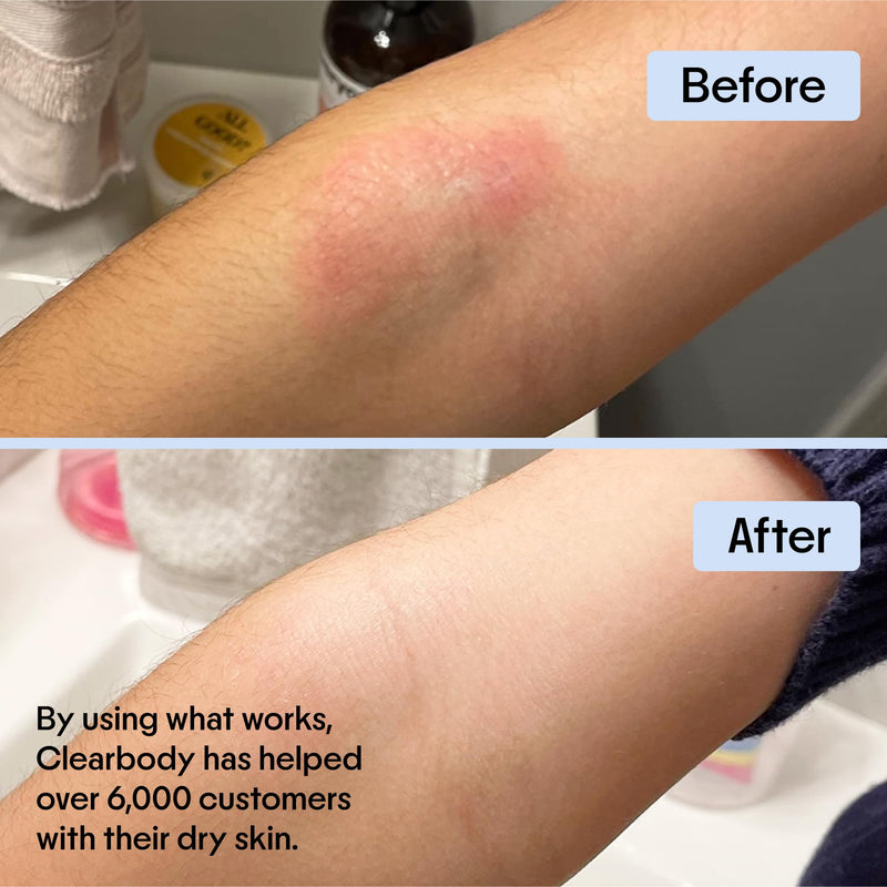 Clearbody Organics Manuka Honey Cream for Eczema & Dry Skin - Colloidal Oatmeal & Aloe - No Greasy Residue - 1 oz
