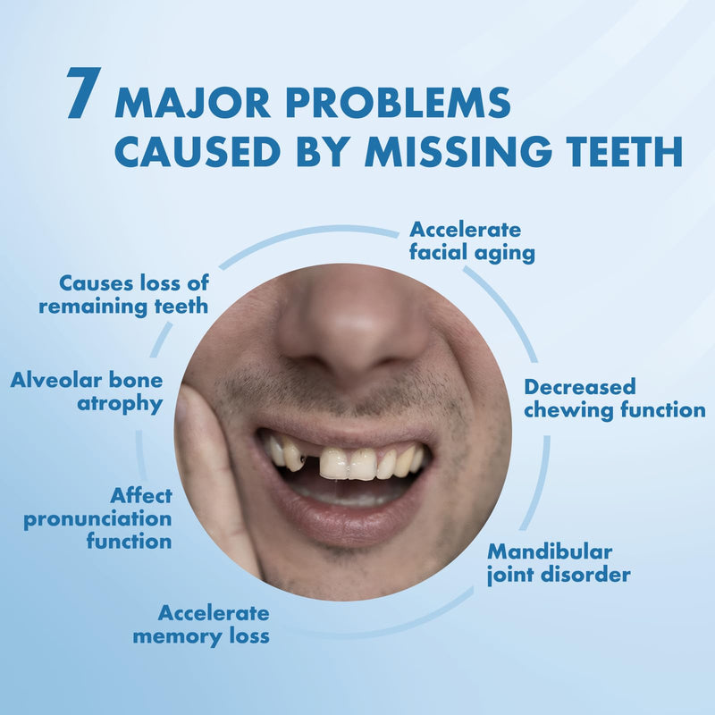 Custom Removable Dentures – Personalized Partial Denture Set | 1–6 Teeth