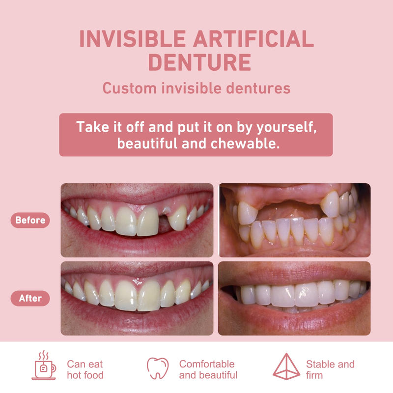 Custom Partial Dentures – Personalized Removable Denture Set (1–6 Teeth) with Storage Case