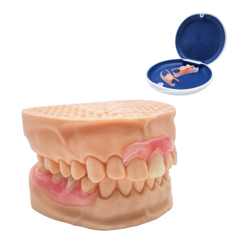 Custom Partial Dentures – Personalized Removable Denture Set (1–6 Teeth) with Storage Case