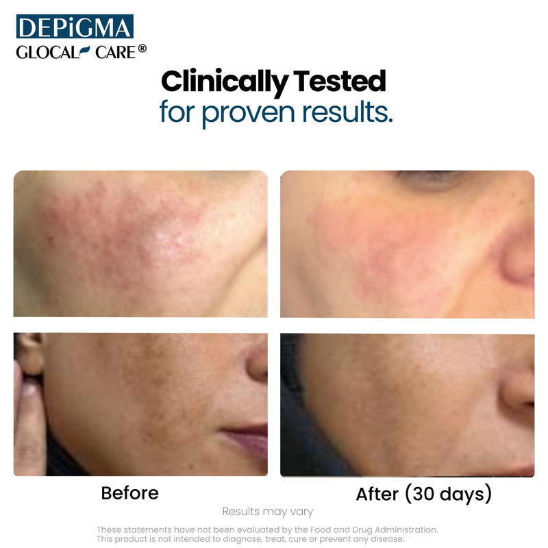 GlocalCare Depigma Support Reduction of Hyperpigmentation, Melasma & Dark Spots with Glutathione, Polypodium Leucotomos, Grape Seed & Marigold Extract