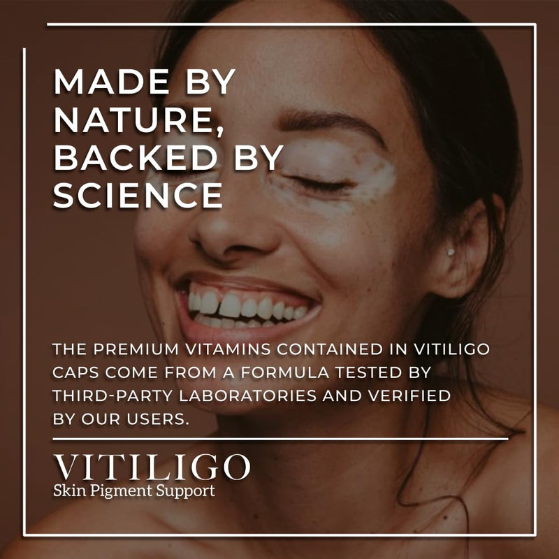 Dermawonder Vitiligo Capsules 60 Count - Support Pigmentation & Reduce White Spots