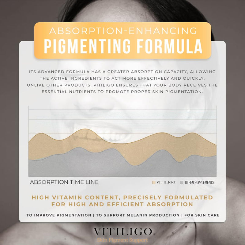 Dermawonder Vitiligo Capsules 60 Count - Support Pigmentation & Reduce White Spots