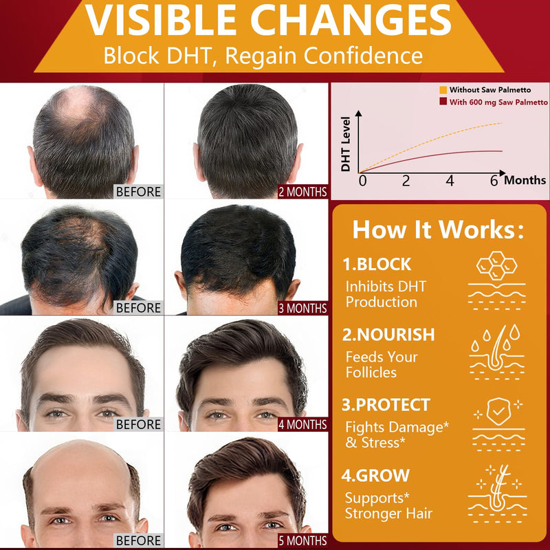 DHT Blocker for Men | Extra Strength Saw Palmetto & Biotin Hair Growth Supplement - Hair Growth Vitamins - Hair Regrowth - Natural Hair Loss Supplements for Men - Proprietary Herbal Blends,1 Pack