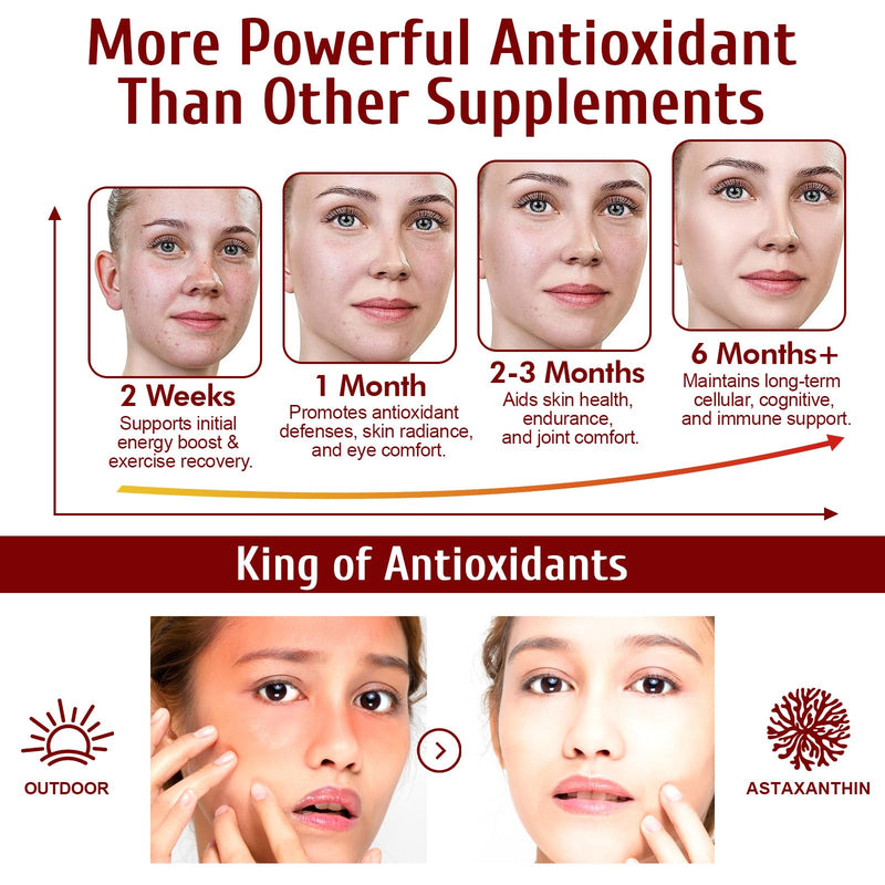 Astaxanthin 12mg Softgels – Triple Strength Antioxidant for Eye, Skin, Brain & Immune Support | 120 Count