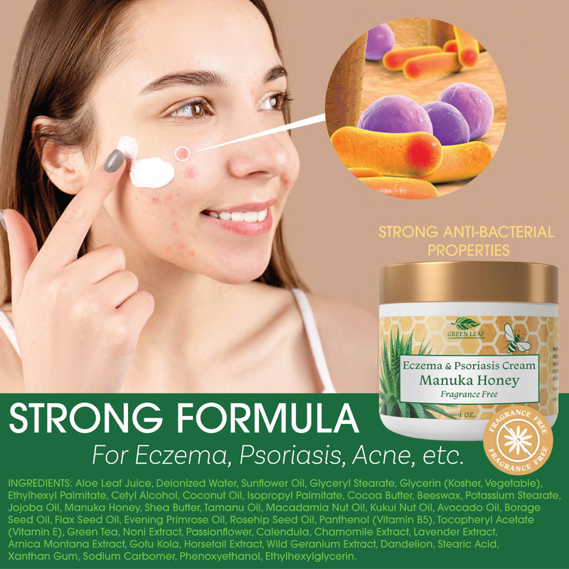 Green Leaf Naturals Manuka Honey Eczema Cream – Fragrance-Free Moisturizer for Dry Skin, Eczema & Psoriasis (2oz)