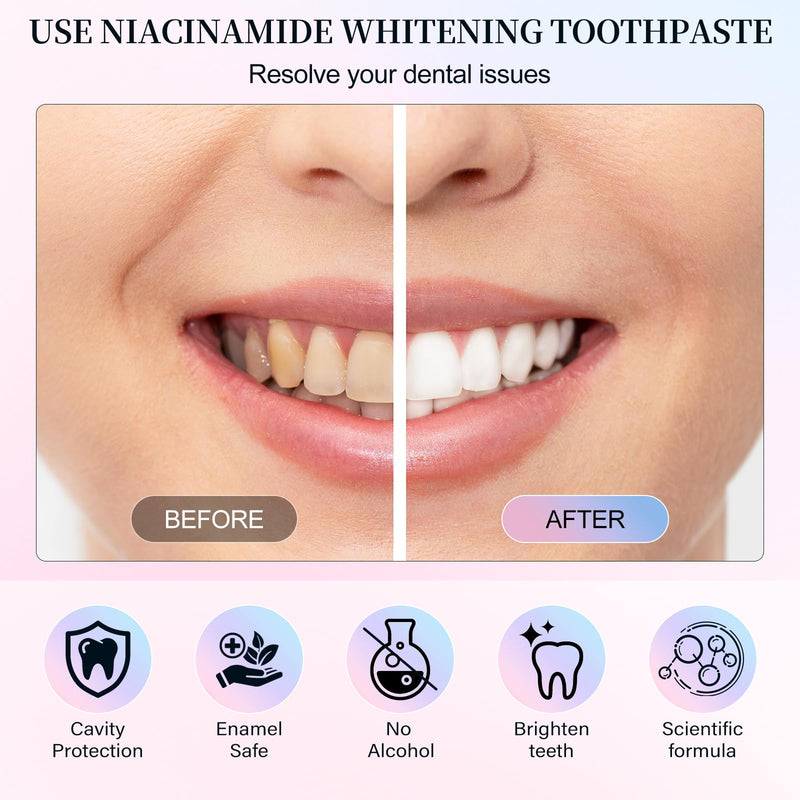 Niacinamide Whitening Toothpaste – Natural Gentle Care, Deep Stain Removal, Fresh Breath, Gum Health | 3.8 oz