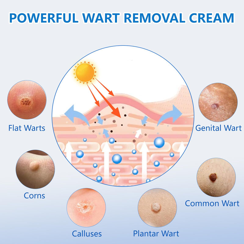 KIbabyDI Wart Remover Gel – Fast-Acting Freeze Off for Genital & Plantar Warts | 2PC-Red-222