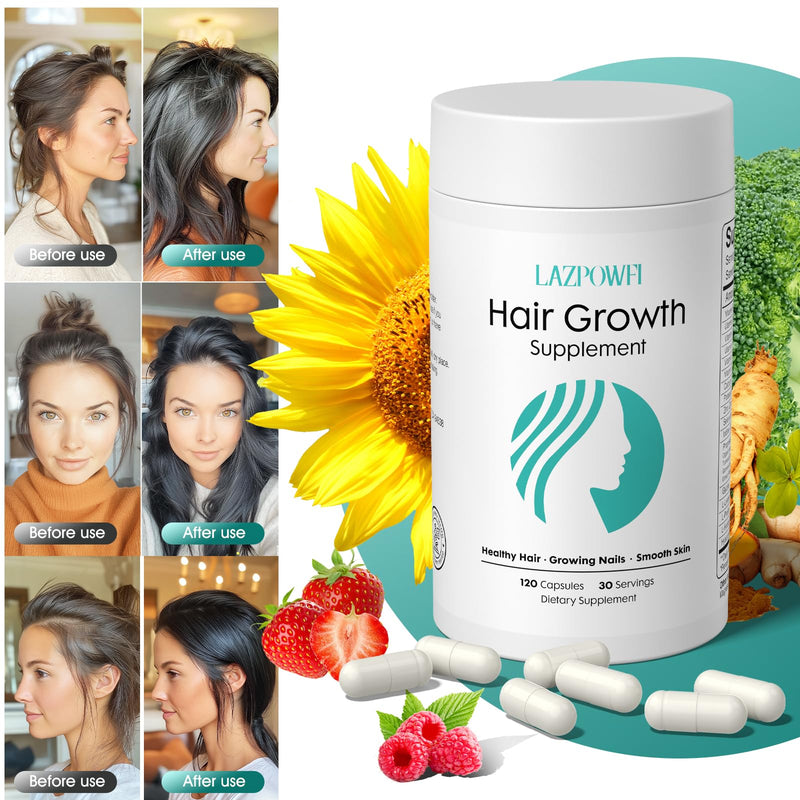 Lazpowfi Hair Growth Supplements - Biotin 10000mcg, 30-in-1 Vitamins