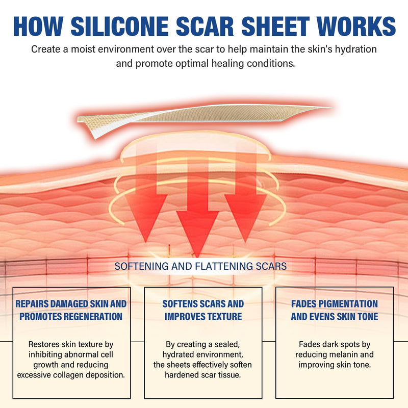 Mitreal Silicone Scar Sheets & Tape — 1.6x158 Roll for Surgical Scars & Keloids