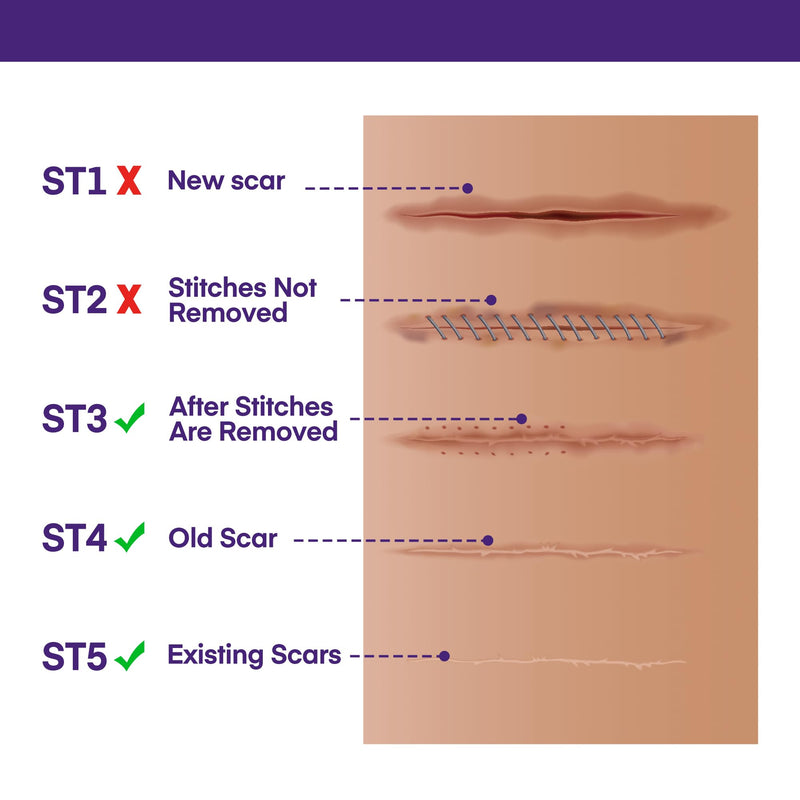 MURASAKI BEAUTY Silicone Scar Gel SPF 30 – Medical-Grade Scar Cream (1.06oz)