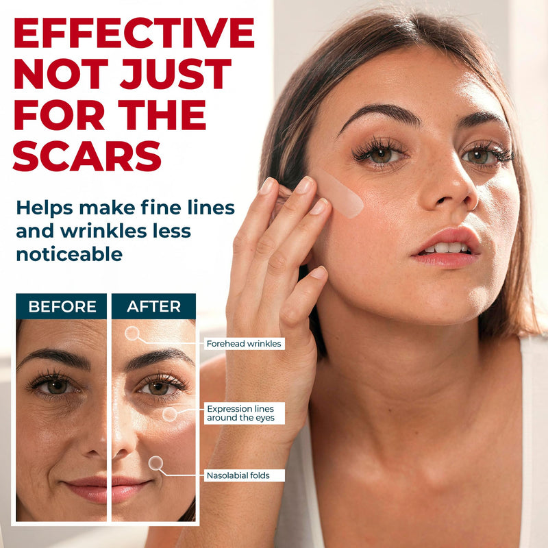 MYHELP Medical Grade Silicone Scar Sheets - Transparent 6pk (5.7x1.6 in) | Visible Difference