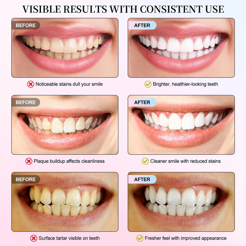 Niacinamide Whitening Toothpaste | Intensive Whitening, Stain Removal, Enamel Protection (1PC)