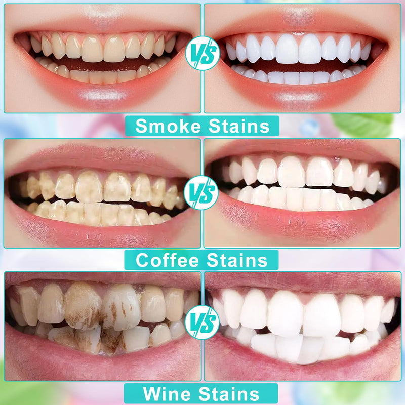 Niacinamide Whitening Toothpaste - Gentle, Fluoride-Free for Fresh Breath & Oral Health