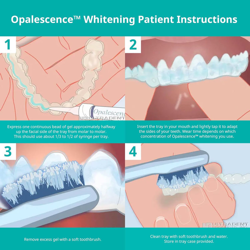 Opalescence 35% CP Mint Gel Syringes Refill Kit (4 Syringes) – Ultradent 5197-2tb