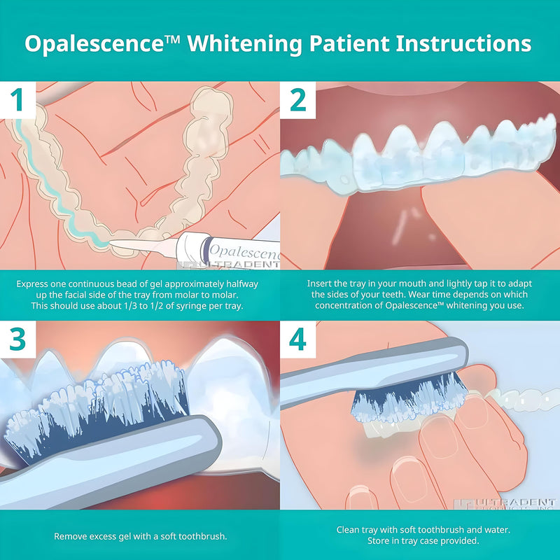 Opalescence 20% Teeth Whitening Gel Refill Kit (12 Syringes) Mint – Ultradent