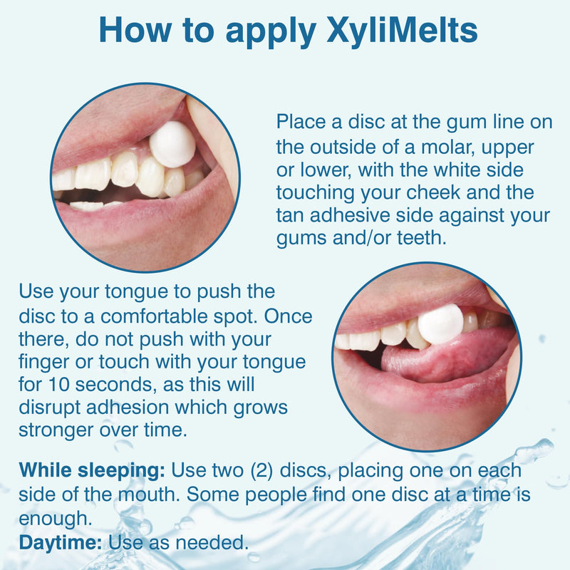 Oracoat XyliMelts Dry Mouth Discs – 230 Count, Sugar-Free Xylitol, 8-Hour Relief
