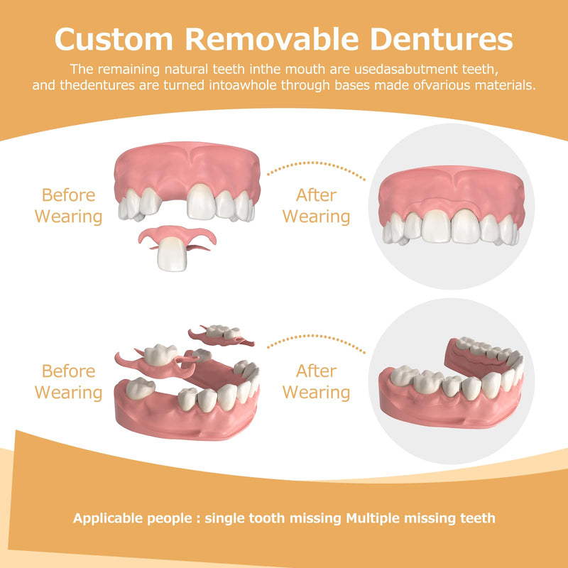 Partial Dentures - Lightweight, Unbreakable Replacement Teeth (5 Teeth) for Missing Teeth | Men & Women