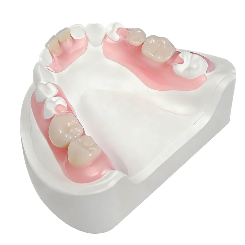 Partial Dentures - Custom Removable Tooth Replacement for Missing Teeth (1 Tooth)