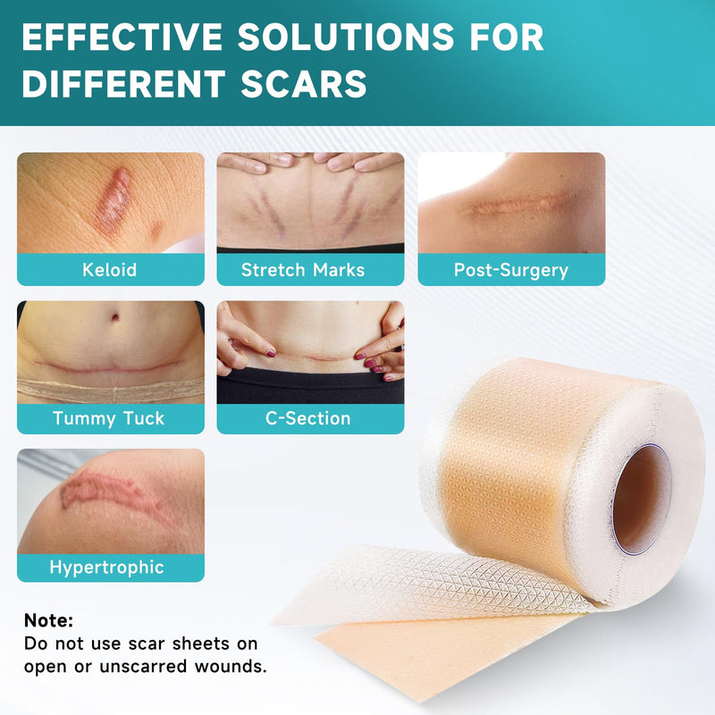 Pumkot Silicone Scar Sheets & Tape – 1.6”x60” Roll for Surgical Scars, C-Section & Burns