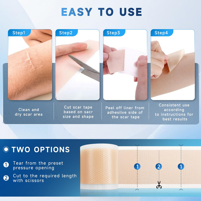 Rvlaim Silicone Scar Sheets – 1.8” x 157” Roll for Surgical Scars, Keloids, Stretch Marks